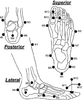 Diagram of foot shows a schematic of the Milwaukee foot model.