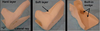 Three views of a prototype foot orthosis