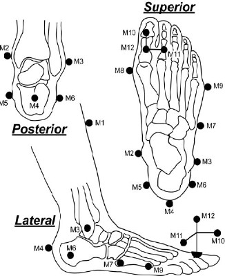Diagram of foot shows a schematic of the Milwaukee foot model.