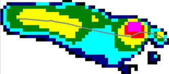 Schematic shows the pressure distribution of a foot.
